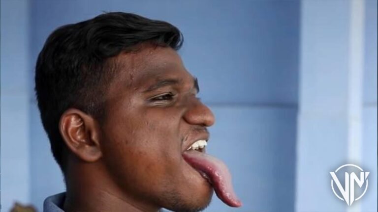 ¡Va por el récord Guiness! Joven presume su lengua de casi 11cm de largo (+Fotos)
