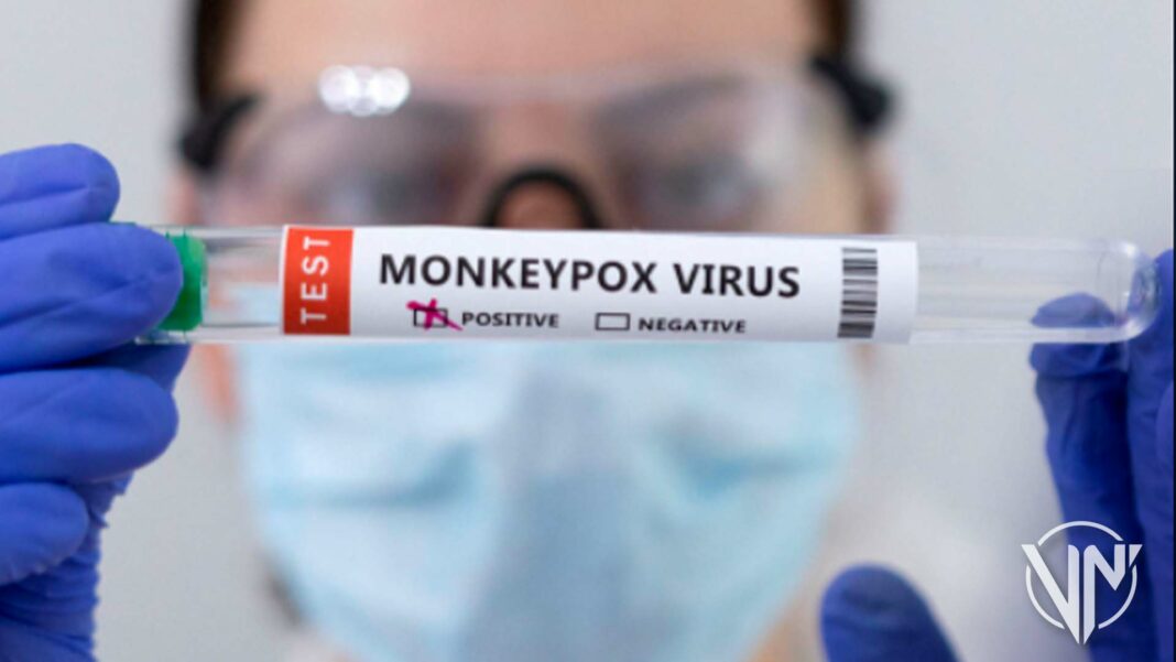 OMS confirma 131 casos de la viruela del mono en 19 países