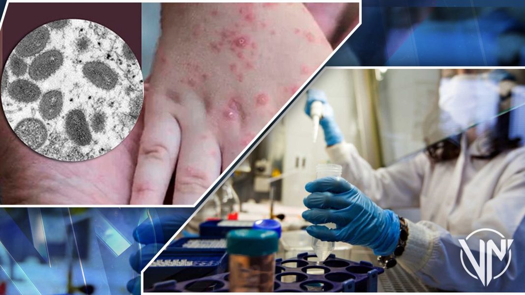 Rusia culmina ensayos clínicos contra la viruela símica