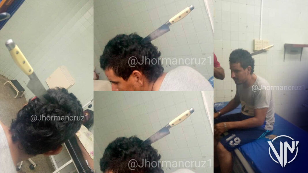 Zulia: Detenida mujer por clavarle cuchillo en la cabeza a su pareja