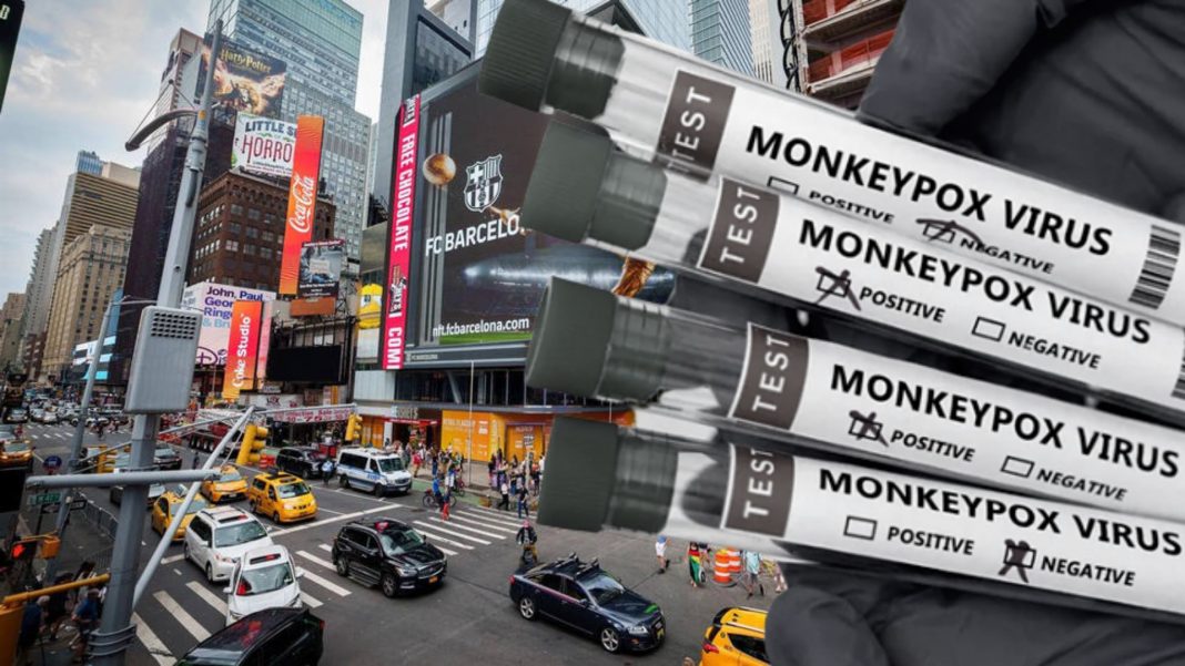 viruela del mono Nueva York