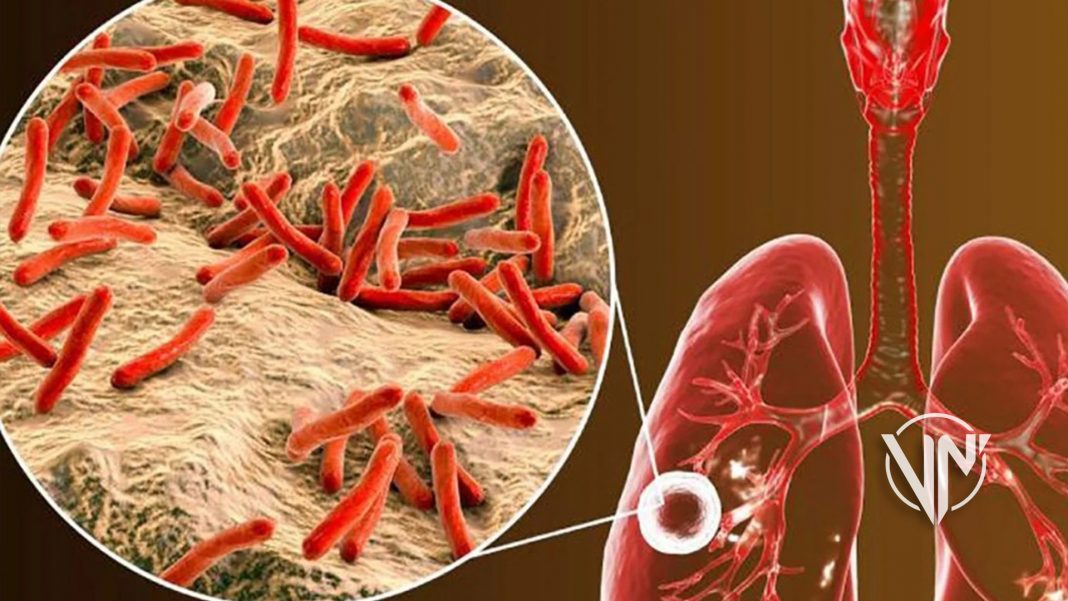 OMS advierte sobre aumento de casos de tuberculosis en el mundo