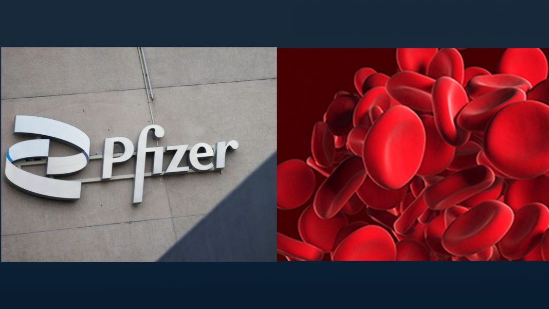 Pfizer adelanta resultados positivos en su terapia génica para la hemofilia B