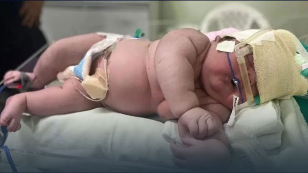 Nació un superbebé de más de 7 kilos y rompió un récord en Brasil