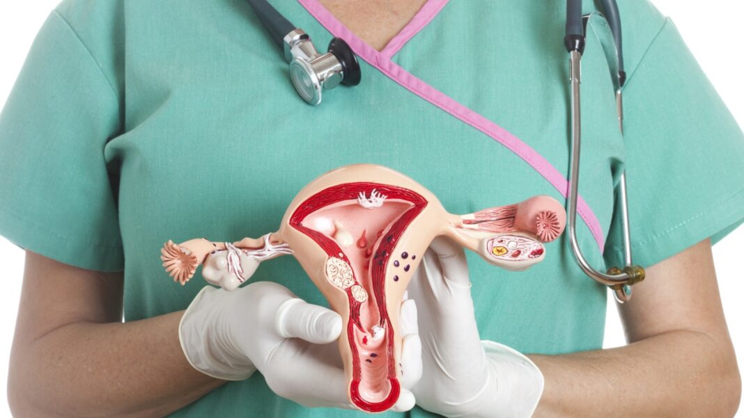 tratamiento Cáncer Cuello Uterino mortalidad